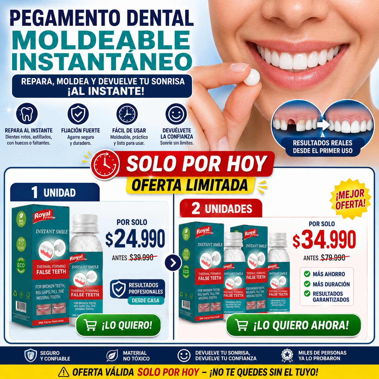 INSTANT SMILE I PEGAMENTO DENTAL MOLDEABLE INSTANTANEO